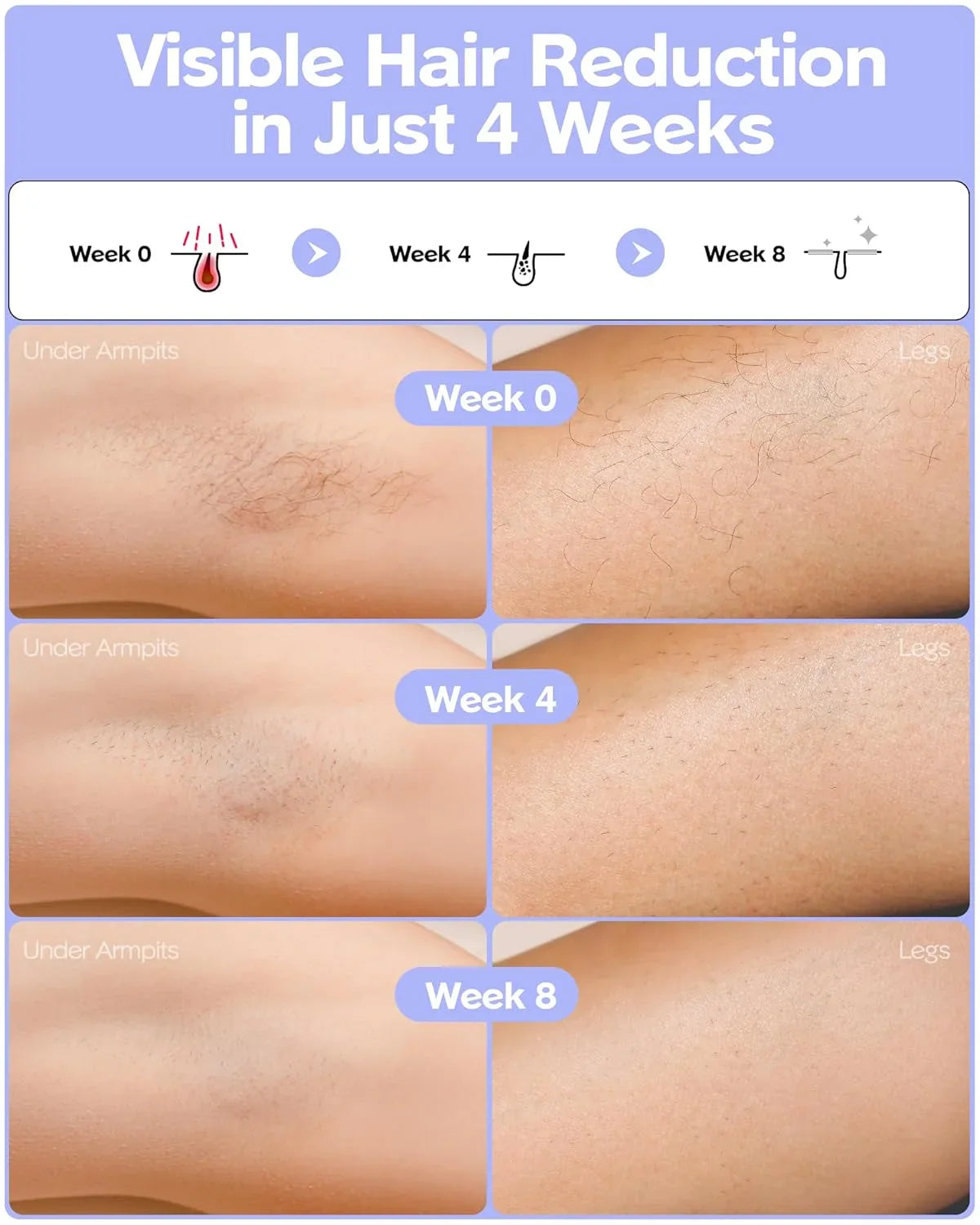 Fashiquee IPL Laser Hair Removal Device