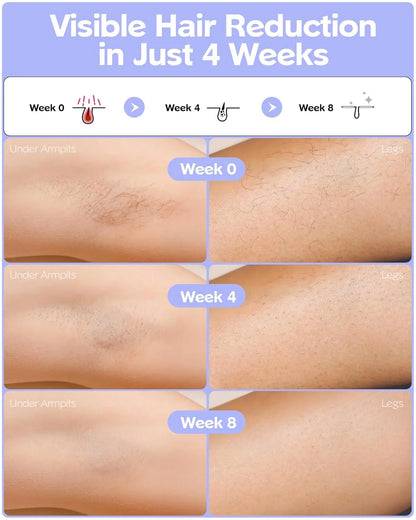 Fashiquee IPL Laser Hair Removal Device